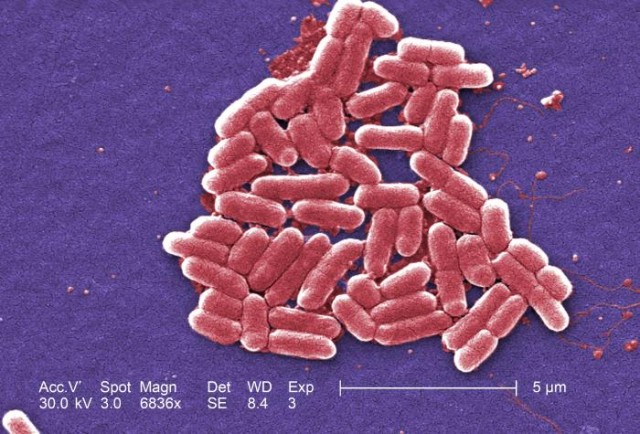photo of Evolving bacteria to produce more of all sorts of useful chemicals image