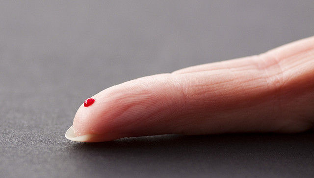 photo of New study spills doubt on some fingerprick blood tests image