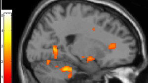 In games, brains work differently when playing vs. a human