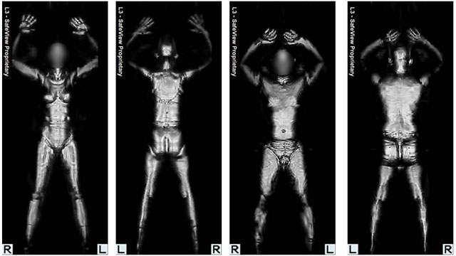 voyeur full body xray scan images
