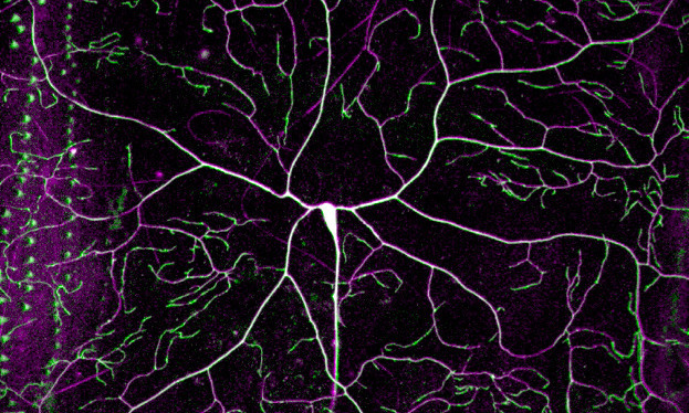 Modeling neuron death with real and simulated decapitations