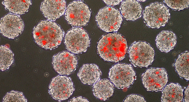 Researchers lose bid to block human embryonic stem cell research