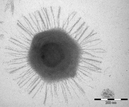 Giant viruses may have evolved from cellular organisms, not the other way around