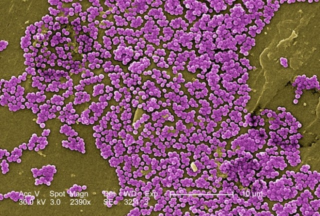 Multiple drug-resistant Staphylococcus aureus bacteria seen under an electron microscope.