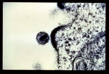 HIV "buds" out of immune cells, like this T cell.