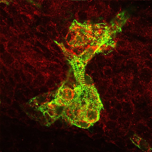 Cardiac muscle cells derived from human embryonic stem cells