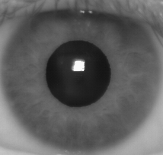This is the type of image that an infrared iris scanner would capture.