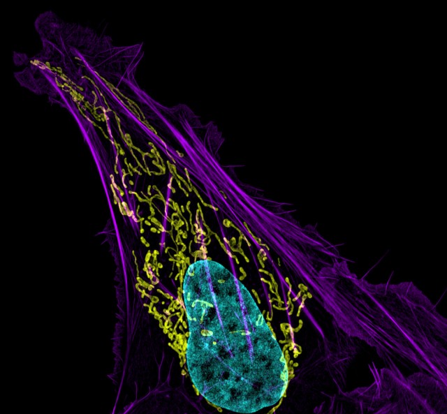 This image of an osteosarcoma cell comes courtesy of Dr. Dylan Burnette of the National Institutes of Health. Each color represents a different cellular component.