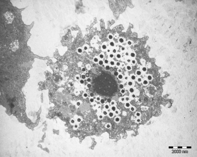 Giant viruses being built inside an infected cell.