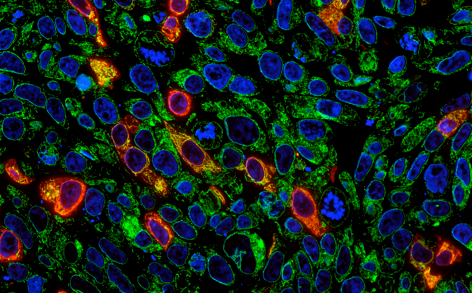 Antibodies, combined with fluorescent molecules, provide this image of a mixed cell population. But for each color involved, you need antibodies from a different species.