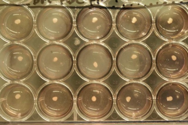 The researchers' liver buds growing in culture prior to transplant into an animal.