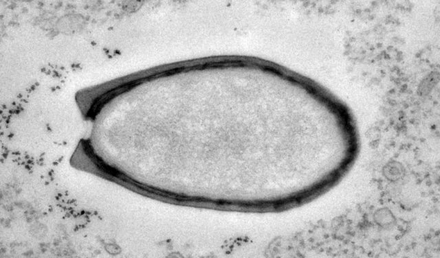 Meet the Pandoravirus, which carries more DNA than some bacteria.