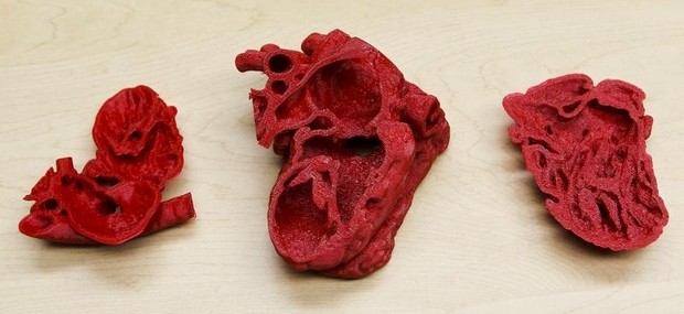 A 3D model of the heart of Roland Lian Cung Bawi, 14 mos. Engineers at UofL's Speed School created the model in three sections to help doctors at Kosair repair the heart. 