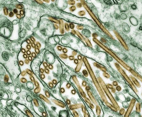A colorized image shows H5N1 avian flu strain viruses (gold) grown in dog kidney cells (green).