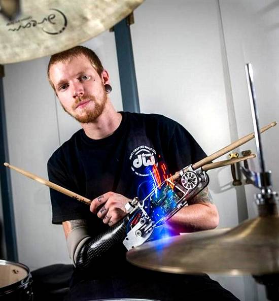 New robotic arm opens up musical worlds for “cyborg” drummer
