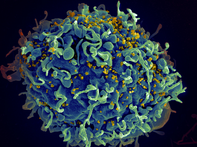 A false-color scanning electron micrograph of a T cell.