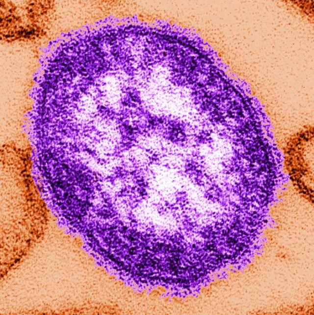 A false color image of the measles virus.