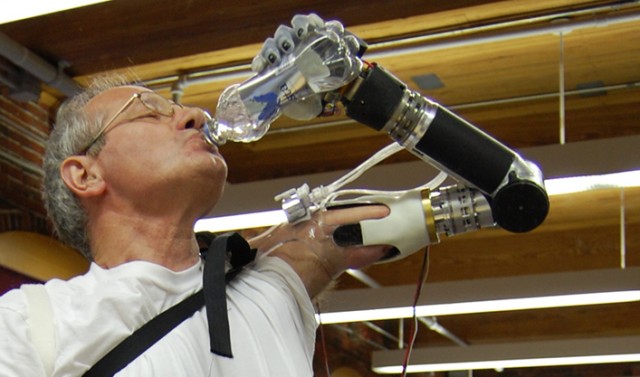 First prosthetic arm wired to muscles approved by the FDA