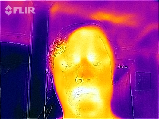 Apparently, my normal every-day resting face is SEVERELY GRUMPY when viewed in infrared.