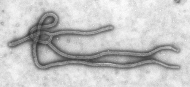 The Ebola virus consists of small but lethal filament of RNA containing only seven genes.