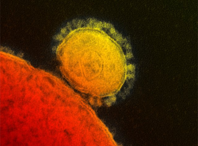 A coronavirus, thanks to proteins studding its surface, latches on to a cell.