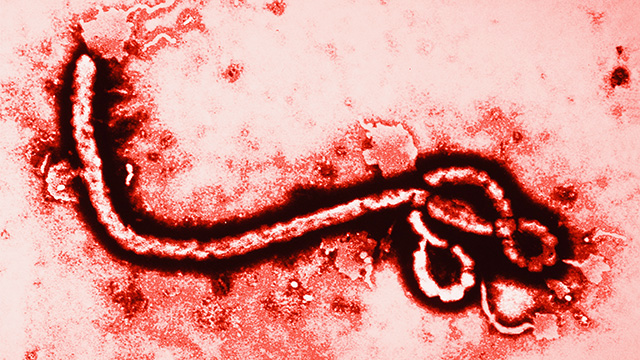 The ebola virus, magnified 108,000 times.