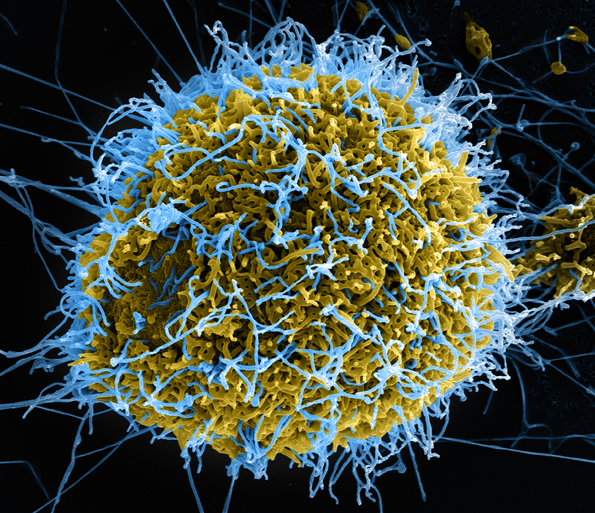 understanding-the-ebola-virus-ars-technica