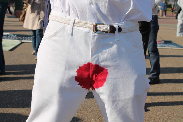 From an "Occupy Foreskin" event in SF.