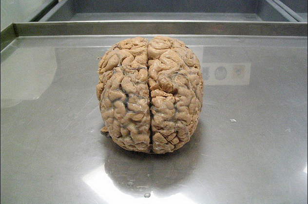 If Software Looks Like A Brain And Acts Like A Brain U2014will