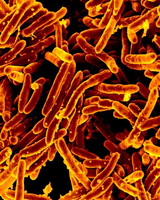 Scanning electron micrograph of <em>Mycobacterium tuberculosis</em> bacteria, which cause TB.