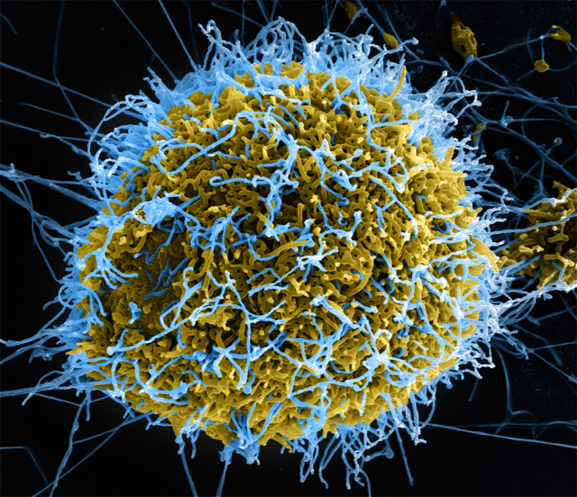 New, whole-virus vaccine for Ebola effective in primates | Ars Technica There Are Four Types