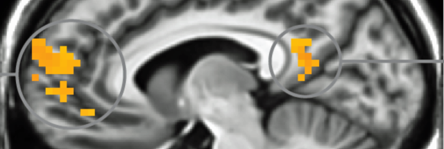 Mris Show Our Brains Shutting Down When We See Security Prompts Ars Mris Show Our Brains Shutting Down When We See Security Prompts Ars