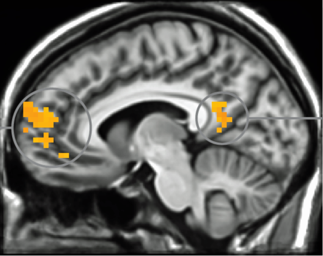 MRIs show our brains shutting down when we see security prompts