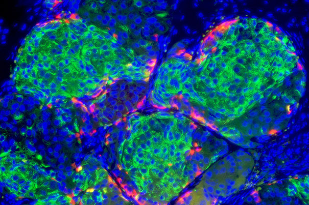 In this image, the insulin-producing cells glow green.