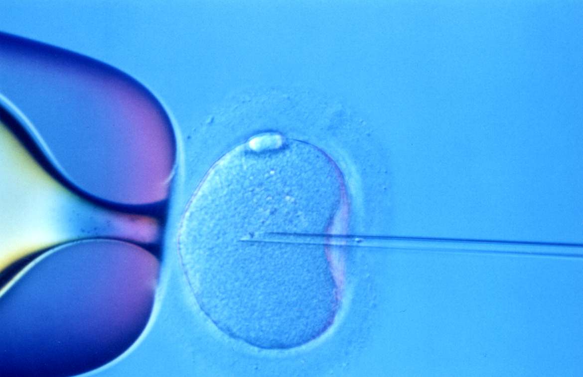 Research team edits the DNA of fertilized human embryos - Ars Technica