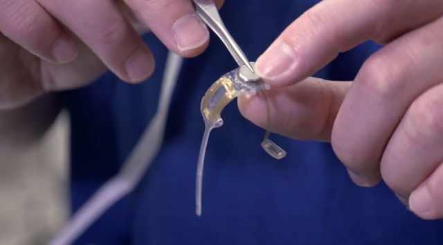 British man receives world’s first bionic eye implant for macular degeneration
