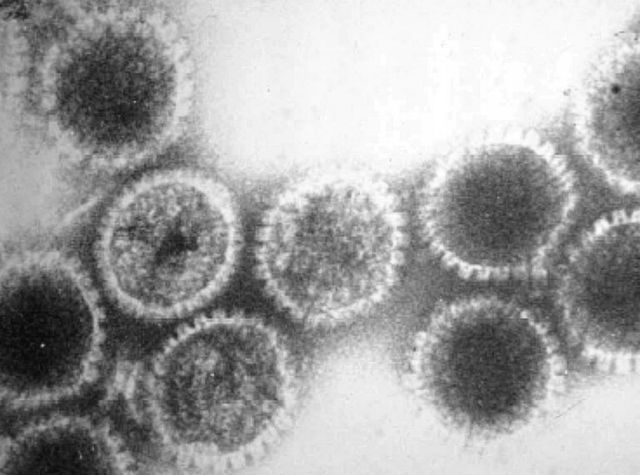 A micrograph of herpes virus. 