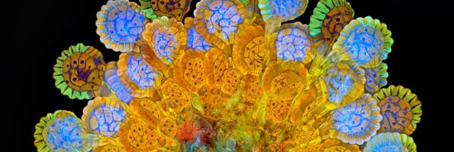 2015 Nikon microscopy contest winners: Science is art