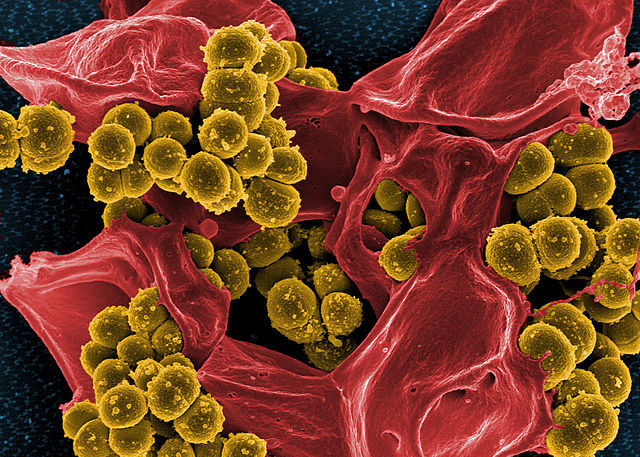 A scanning electron micrograph of methicillin-resistant Staphylococcus aureus and a dead human immune cell.