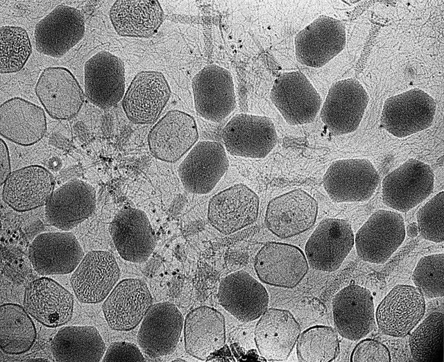 A transmission electron microscopy image of a bunch of bacteriophages.