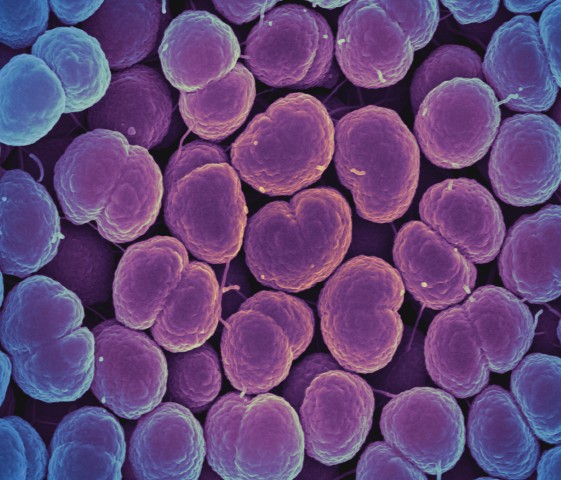 Micrografia eletrônica de varredura colorida da bactéria Neisseria gonorrhoeae, que causa a gonorréia.