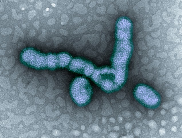 H1N1 flu virus