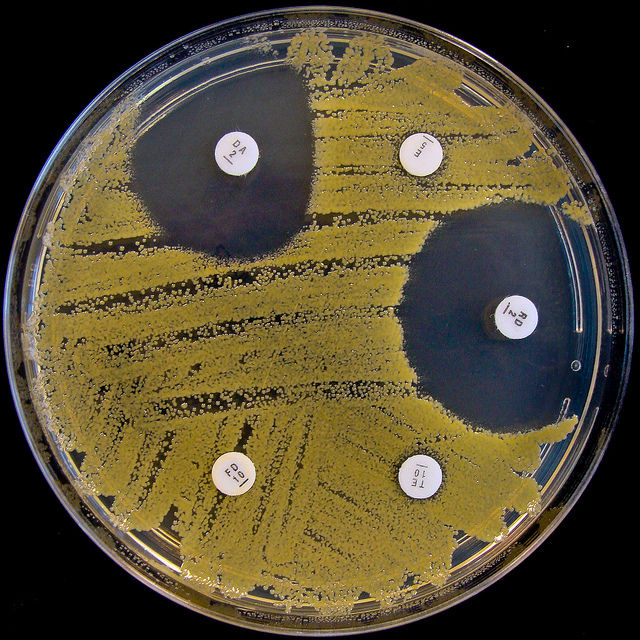 pushy-patients-downvote-doctors-for-giving-antibiotics-responsibly