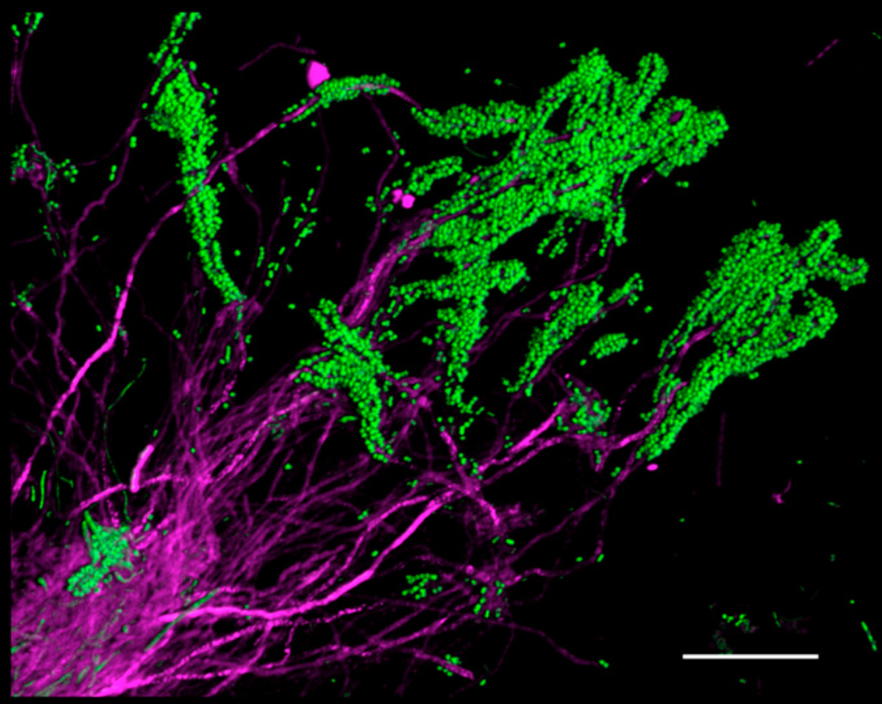 The gunk on your teeth is beautiful and well organized | Ars Technica