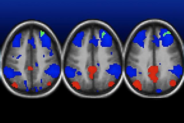 Some types of brain studies need thousands of participants to be reliable