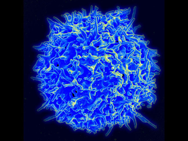 A T cell, the basis for immune therapies against cancer.