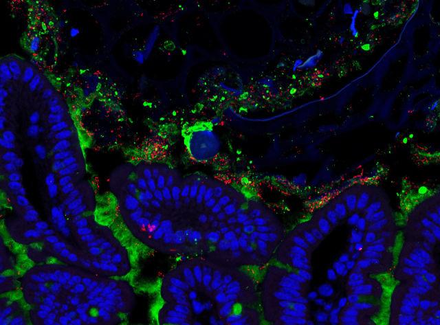 Vancomycin-resistant enterococci (red) colonizing the small intestine (intestinal epithelial cells are blue and the mucus layer is green) of an antibiotic-treated mouse. 
