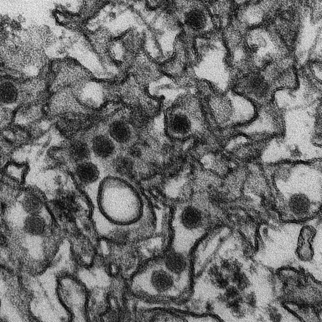 This is a transmission electron micrograph (TEM) of Zika virus, which is a member of the family Flaviviridae. Virus particles are 40 nm in diameter, with an outer envelope, and an inner dense core.