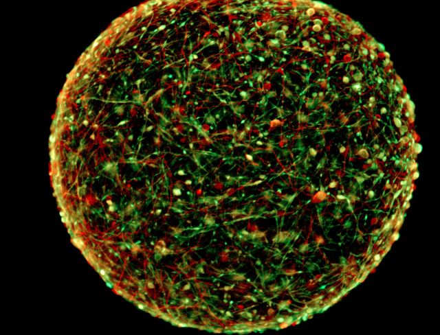 With a few skin cells, scientists can make mini, thinking version of your brain
