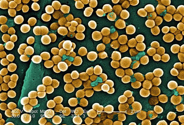 This 2005 scanning electron micrograph (SEM) depicted numerous clumps of methicillin-resistant Staphylococcus aureus bacteria, commonly referred to by the acronym, MRSA; Magnified 9560x.